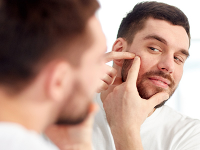 Bouton, Point Noir : comment traiter l'acné d'adulte ?