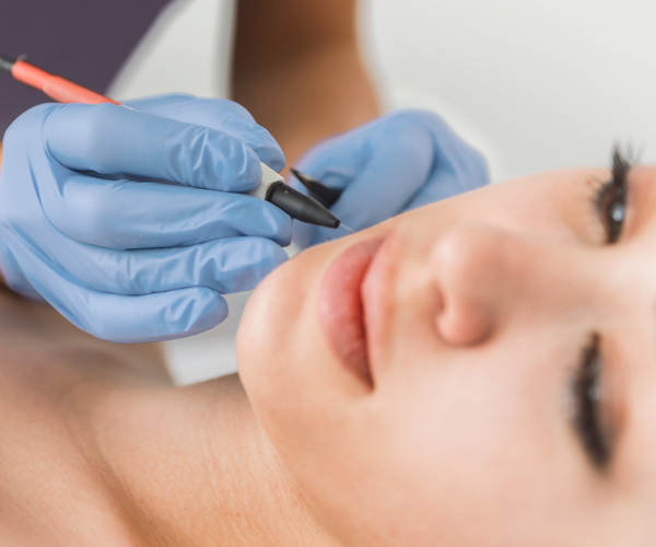 Electrolysis Hair Removal For Face : What You Need to Know | EQlib