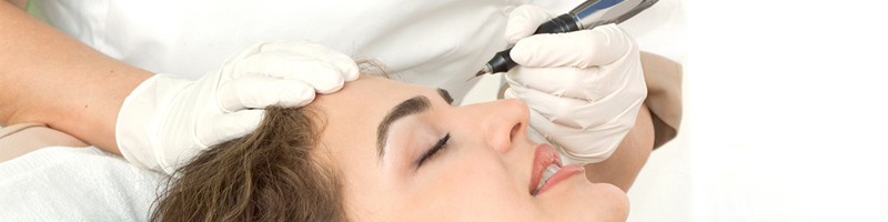 L’Épilation électrolyse du visage : Ce que vous devez savoir