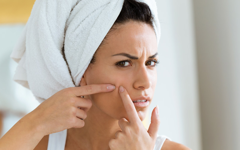 Comment se débarrasser de l'acné : des solutions qui fonctionnent